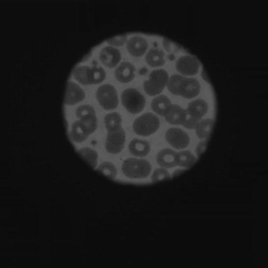 A Closer Look At Liposomes With Cryo-TEM