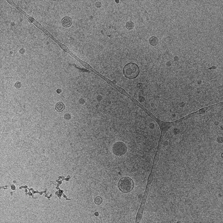 TEM imaging of liposomes