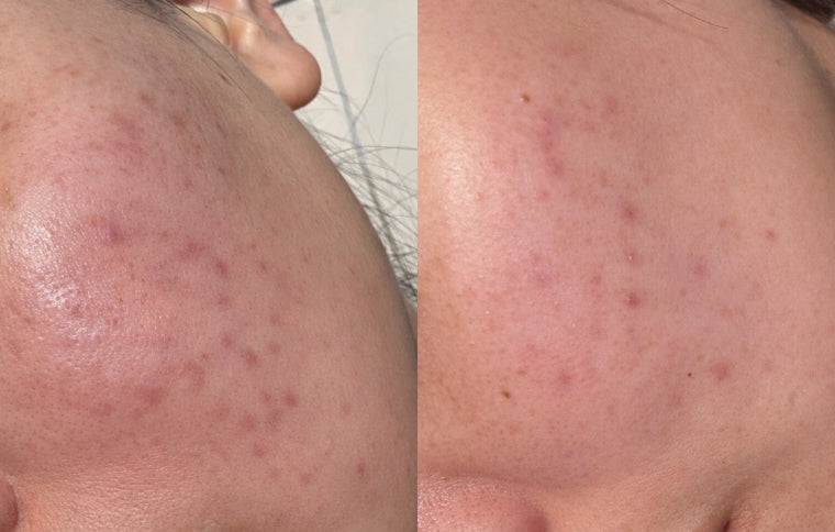 Healthier-Looking Skin