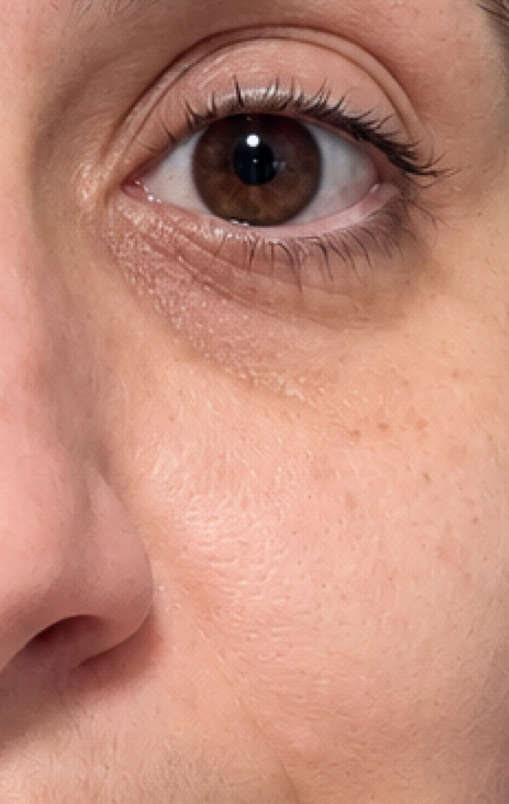 Same study participant at week 8