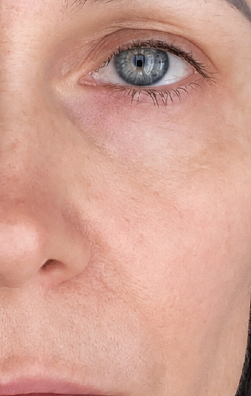 Same study participant at week 8