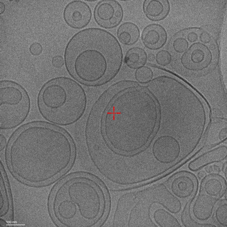 Cryo-TEM micrograph showing visible vesicular structures